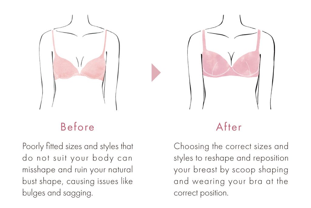 The difference A Bra That Fits makes - the before/after that made